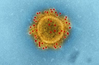 a yellow substance with red dots in it