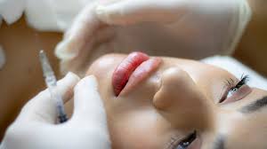 Get Luscious Lips with Dr. Led’s Expert Lip Fillers in Derby