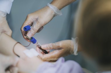 Dr. Karan Jutlla, Head of the Centre for Applied and Inclusive Health Research at the University of Wolverhampton, said this non-invasive blood test is a game-changer for early Alzheimer's diagnosis in the UK.